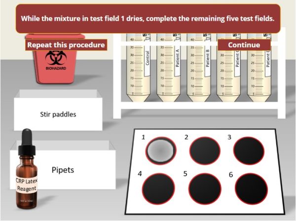CRP Latex Agglutination Test Simulation