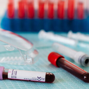 Biotechnology Science Kits